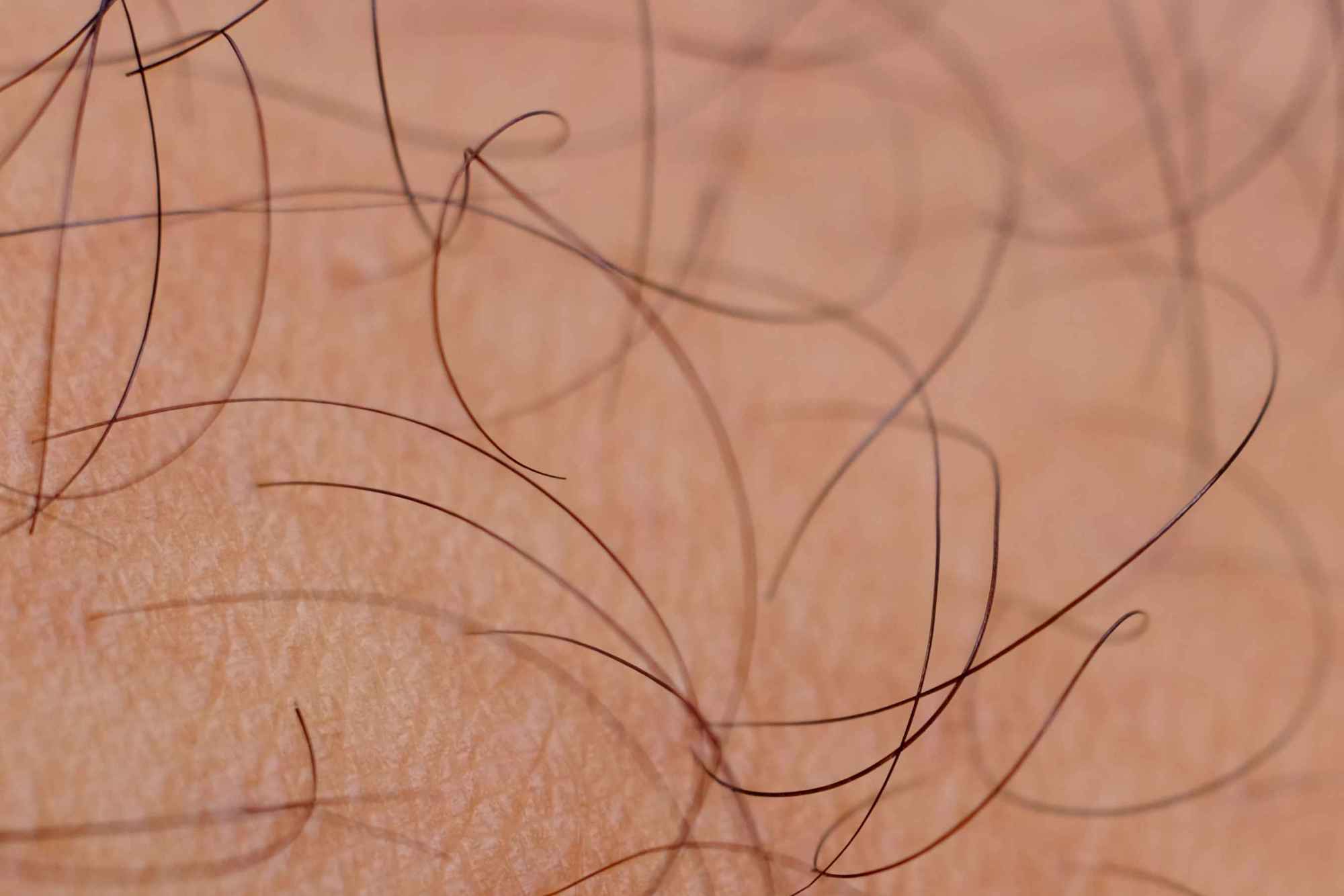 私处毛发应该是直的还是弯的?其实,它有这些作用